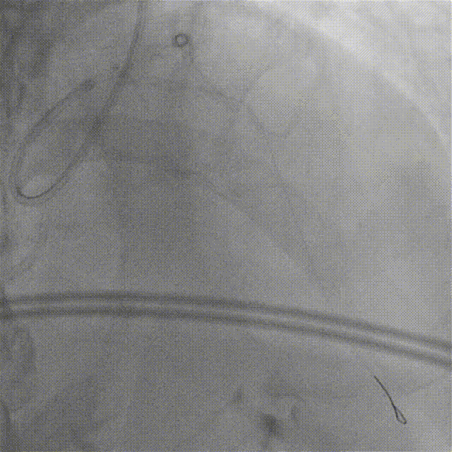 1736744439812448.gif 1736744439812448.gif